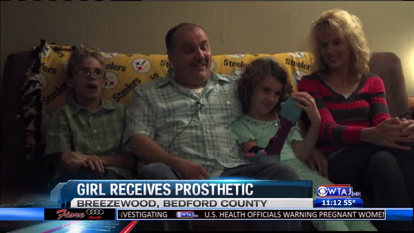 Little girl in Breezewood receives a new prosthetic