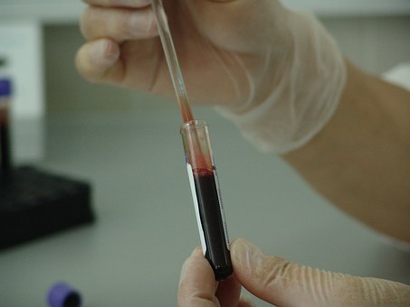 blood in vial_1494453460855.jpg