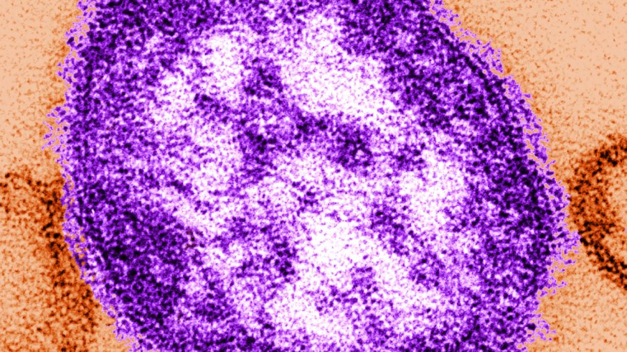 measles virus particle27948296-159532