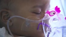 baby on ventilator_1515709920510.jpg.jpg